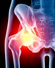 hip image