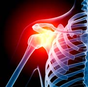 shoulder image